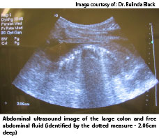 Abdominal ultrasound image of the large colon and free abdominal fluid